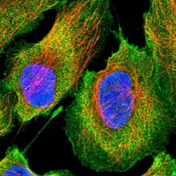 ethanolamine kinase Antibody, Novus Biologicals 0.1mL; Unlabeled:Antibodies,